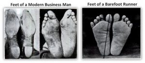 Compare good and bad feet